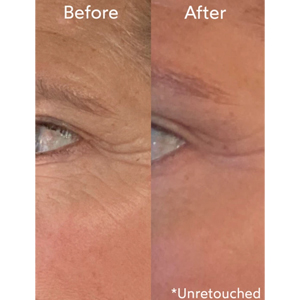 Chebula Active Serum