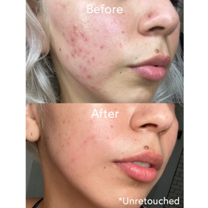 Pure Radiance Oil