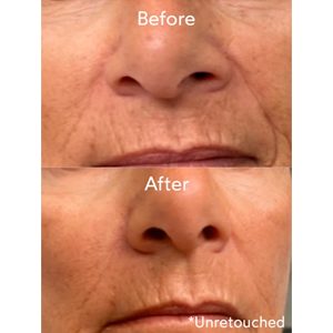 Renew Pure Radiance Oil