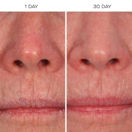 The SUPER Hydrator