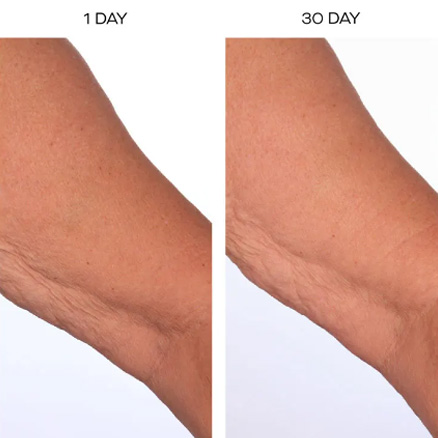 The SCULPT Arm Compound