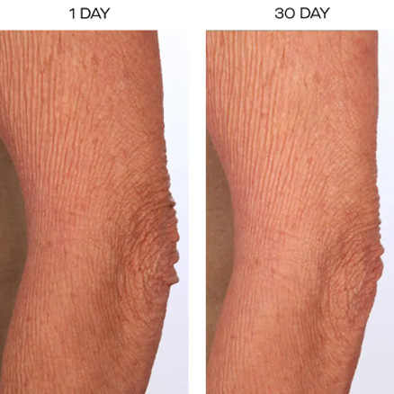 The SCULPT Arm Compound