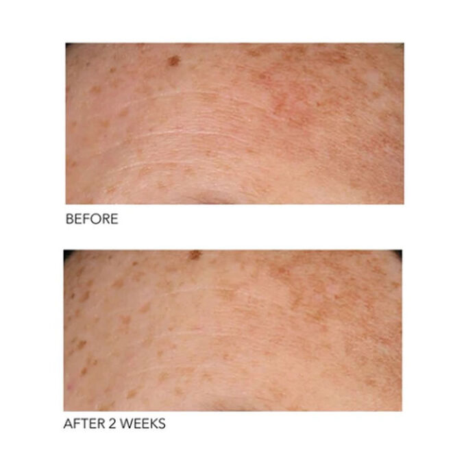 Dr Dennis Gross Alpha Beta Peel Universal Formula 30 Unités Parfums