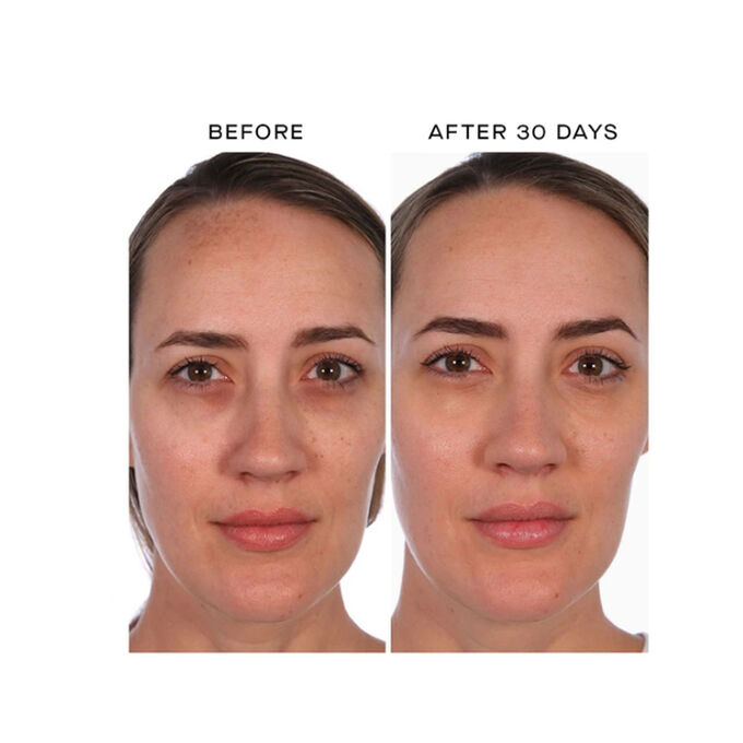 U Beauty Resurfacing Compound 30ml Beautytheshop 面霜 化妆品 网上商店 U Beauty Resurfacing Compound 30ml Beautytheshop 面霜 化妆品 网上商店