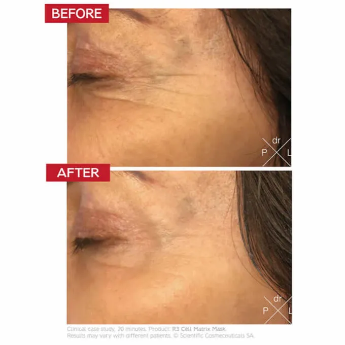 Dr. Levy Switzerland R3 Cell Matrix Mask 50ml | ニッチな香水